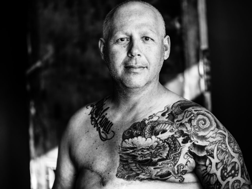 Image of male breast cancer survivor